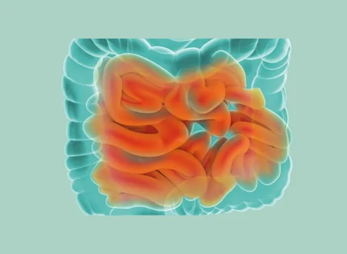 Small Bowel Tumours consultation at Niraaya Hospital